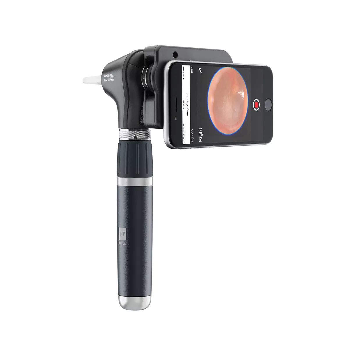 Otoscopio MacroView® Plus - Imagen 3