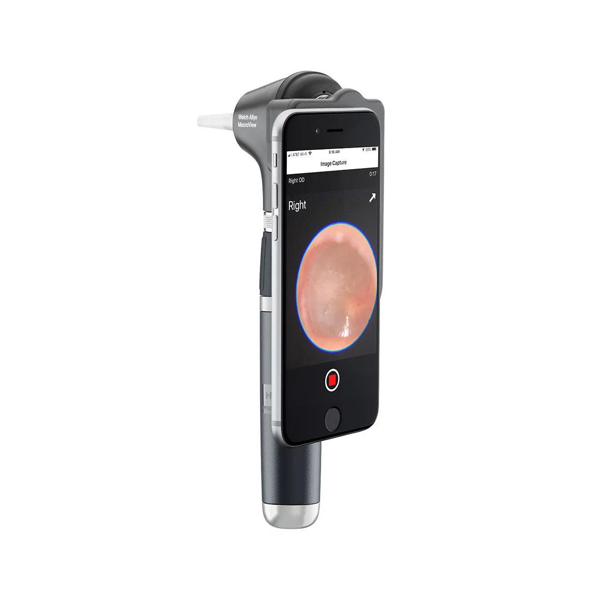 Otoscopio MacroView® Plus
